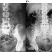 ueg2bf00706-fig-0001-m